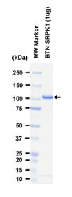 SDS-PAGE (SRPK1-5928HF).jpg